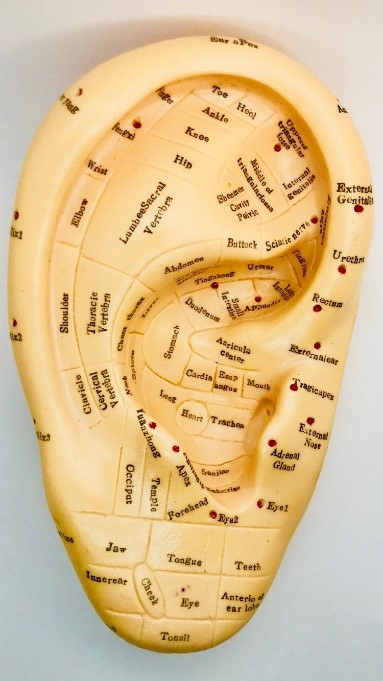 auriculothérapie