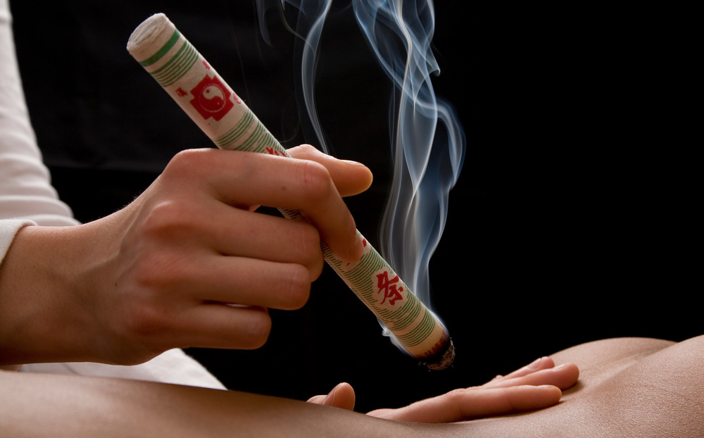 moxibustion